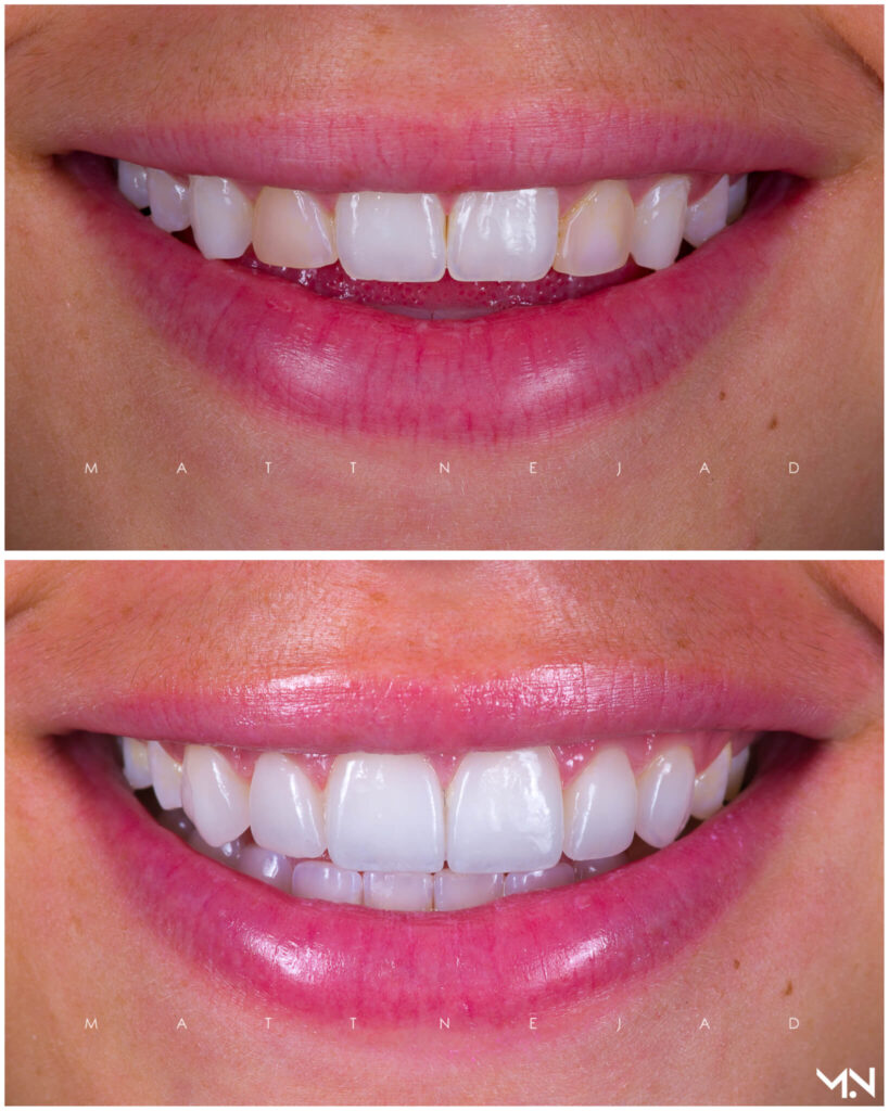 Cosmetic Dentistry Before And After Photos Helm Nejad Stanley