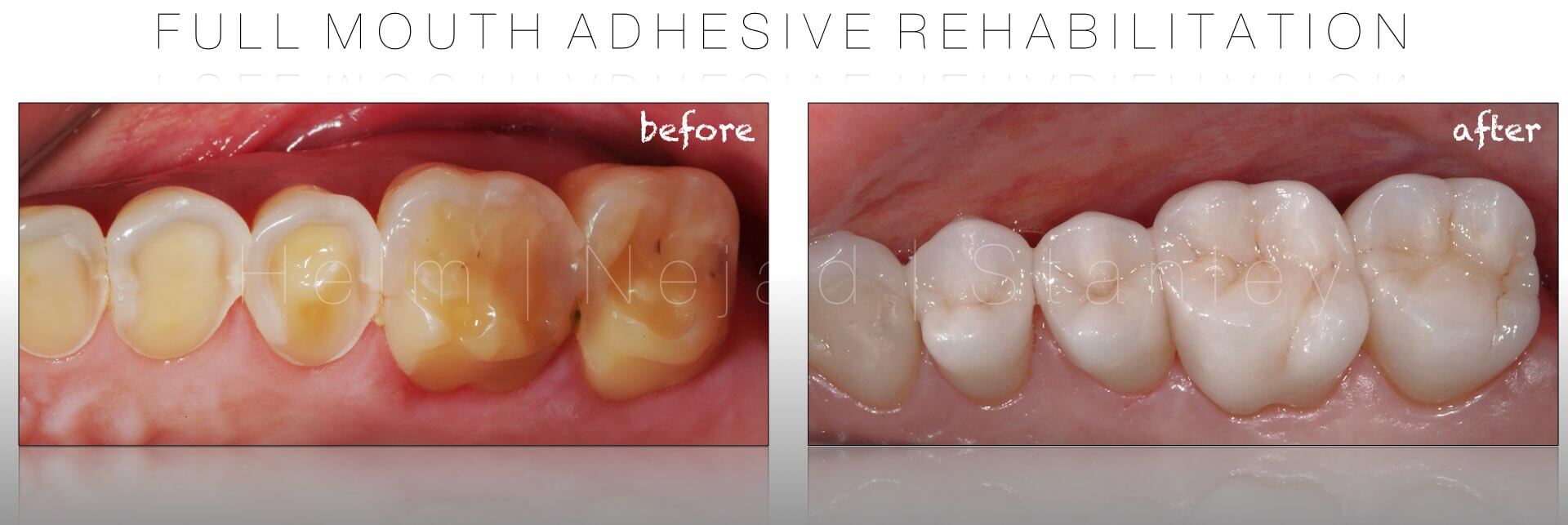 Dentistry Before and After Photos