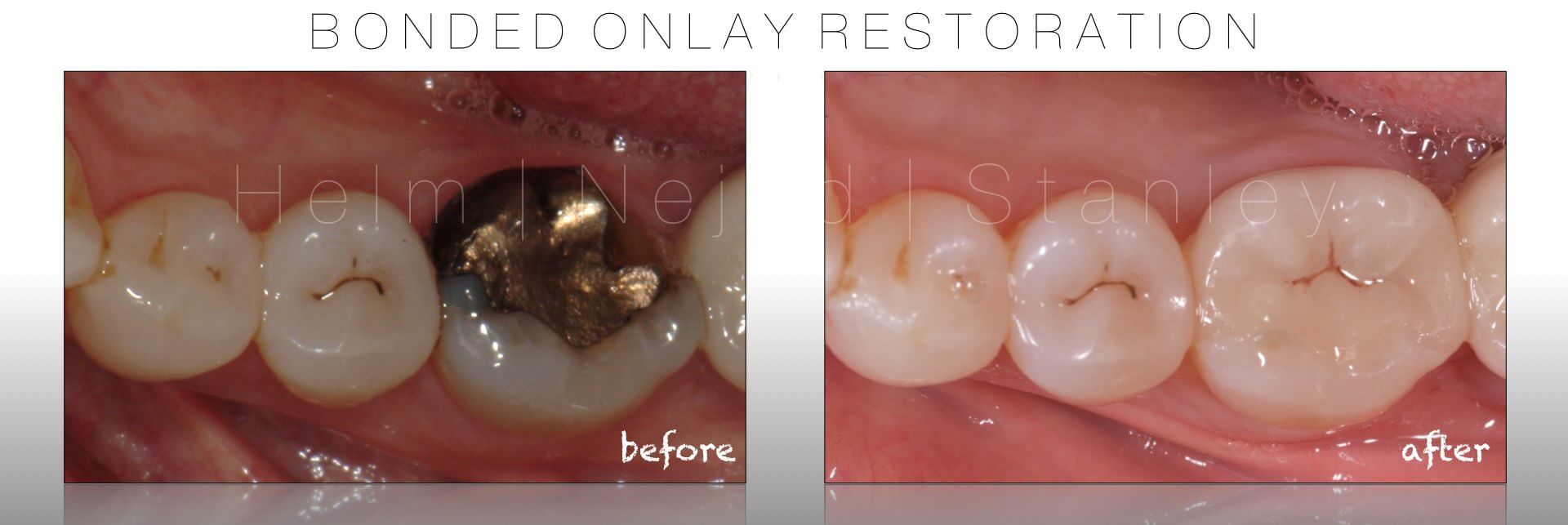 Dentistry Before and After Photos