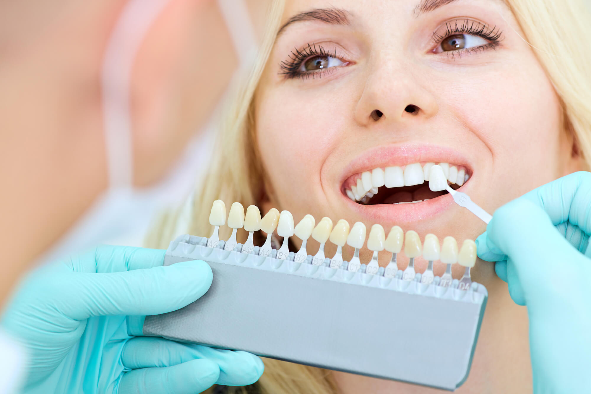 Cosmetic Dentistry And Dental Labs Beverly Hills And Los Angeles