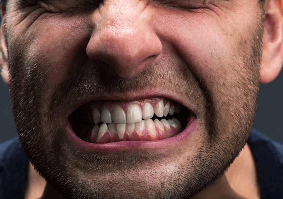 grinding teeth causes gum recession