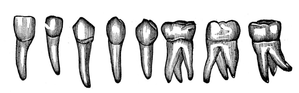 The History of Dental Implants - INFOGRAPHIC | Helm Nejad Stanley