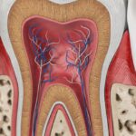 The natural tooth structure is preserved with conservative Dentistry